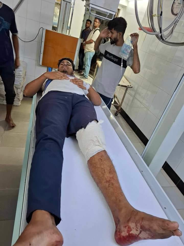 ছাত্রদল নেতার হাঁটুতে অস্ত্র ঠেকিয়ে গুলি 1 IMG 20241029 WA0114