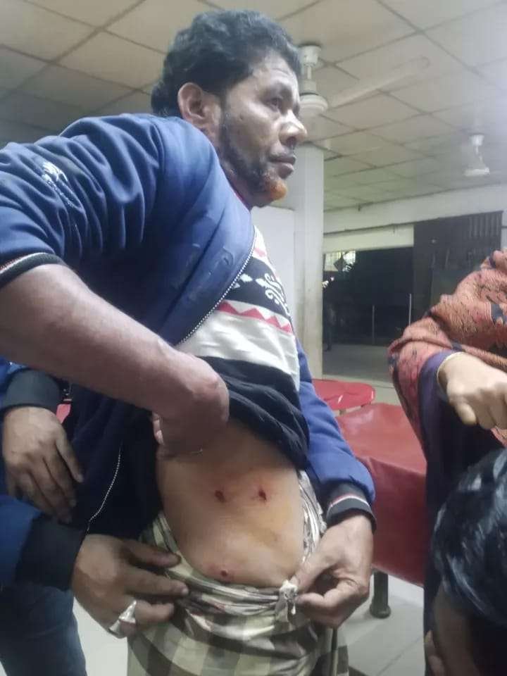 মোটরসাইকেলে এসে প্রকাশ্যে কৃষককে গুলি 1 noakhali 2